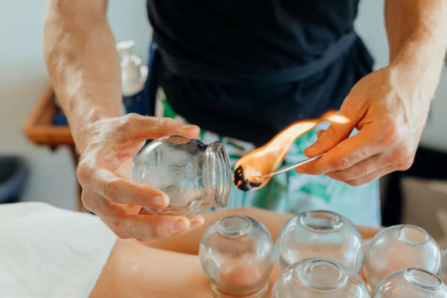 Image of Jay from Mokulua Massage lighting fire in a cup for Chinese fire cupping.